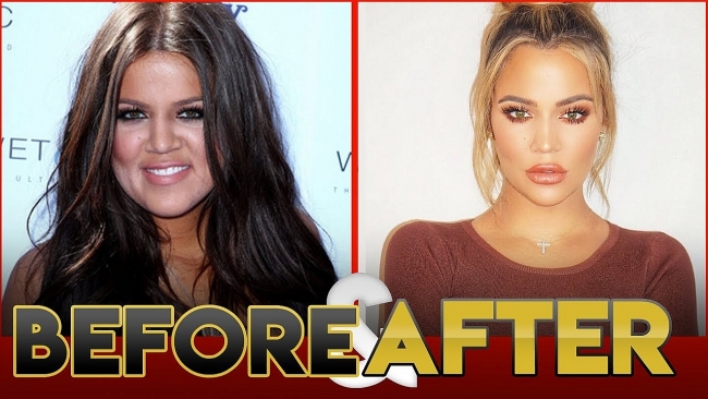 15 Most Impressive Celebrity Transformations: Before and After Picture