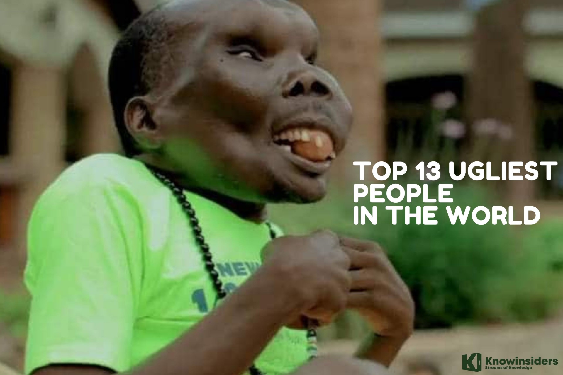 Top 13 Ugliest People In The World Today