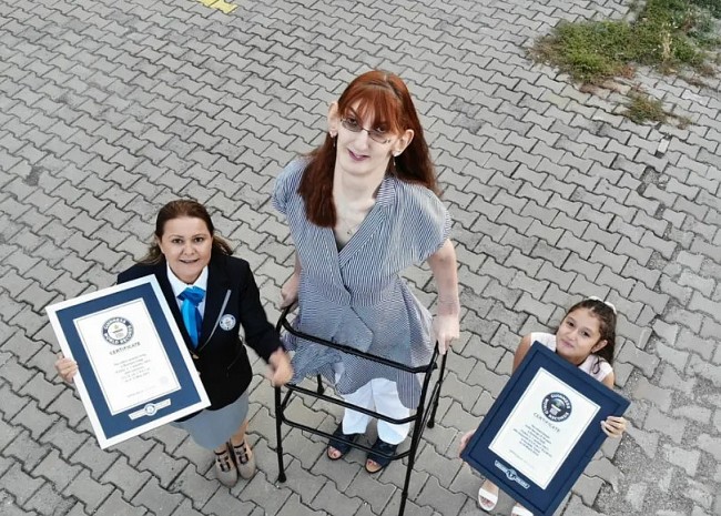 Who is Rumeysa Gelgi - the Tallest Woman in the World with Many Records