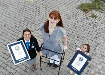 Who is Rumeysa Gelgi - the Tallest Woman in the World with Many Records