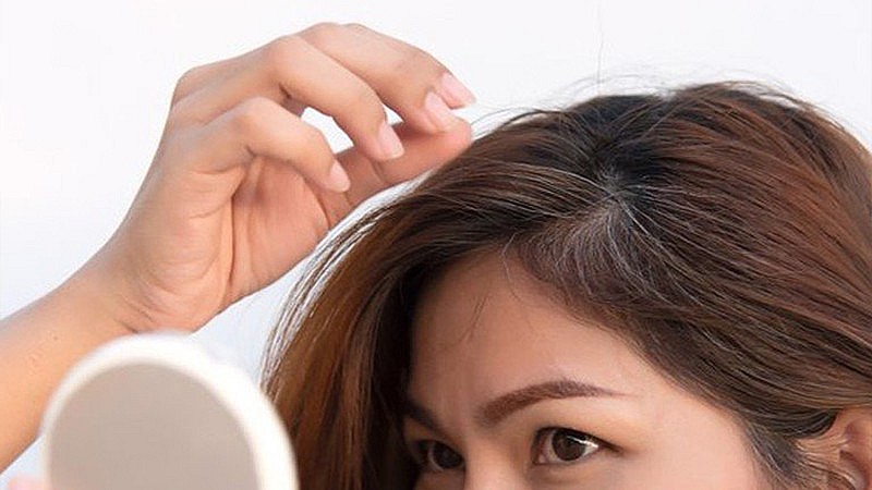 11 Simple Tips to Prevent Premature Greying of Hair