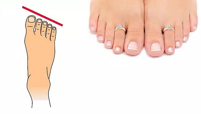 The big toe is longer than the other toes