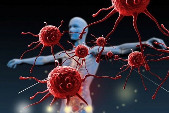 Destroys 99% of Cancer Cells Using 'Molecular Jackhammer' or 'Vibrating Molecules'