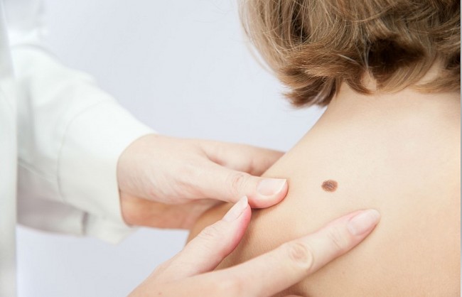 Physiognomy: Mole on the Shoulder Reveals Your Life Destiny