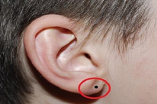 Is it positive or negative if a mole on a man's ear is predicted?