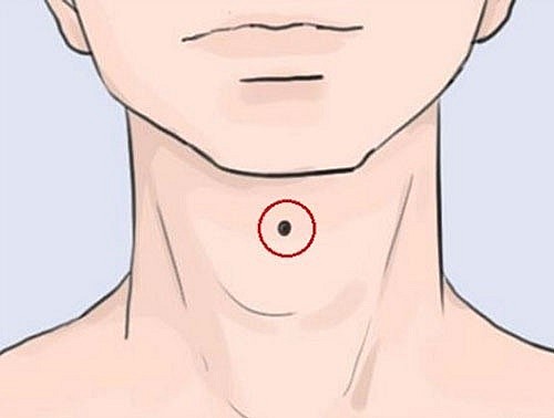Seven Moles on the Neck Indicate Good Luck and A Wealthy Lifetime