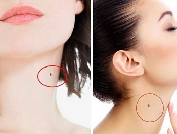 Physiognomy: 7 Moles on the Neck Indicate Good Luck and A Wealthy Lifetime
