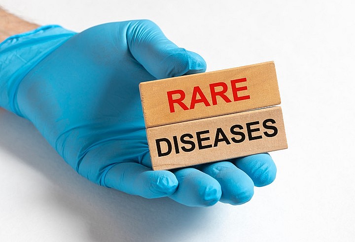 Top 13 Rarest Diseases In The World You Should Know