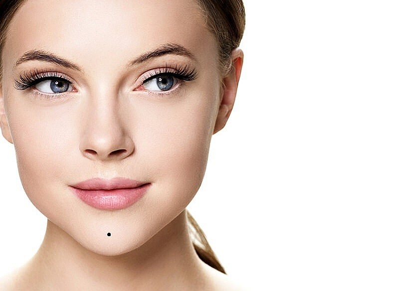 Top 10 Luckiest Moles on Your Body That You Shouldn't Remove