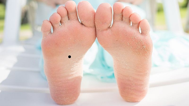 Top 10 Luckiest Moles on Your Body That You Shouldn't Remove