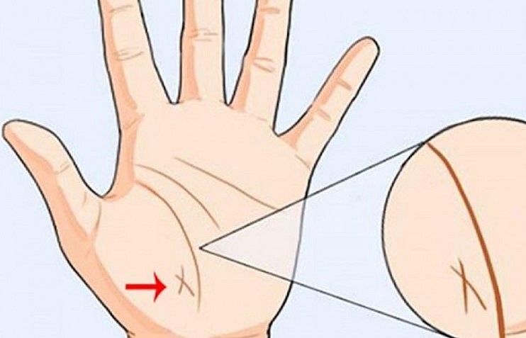 Meaning of an X Sign on Your Palm Based on Palmistry