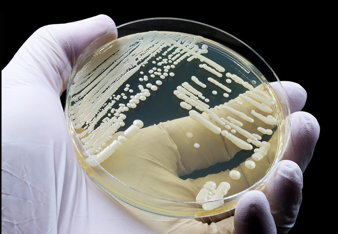 What Is Candida auris? The Drug-Resistant Superbug Now Spreading in 27 States