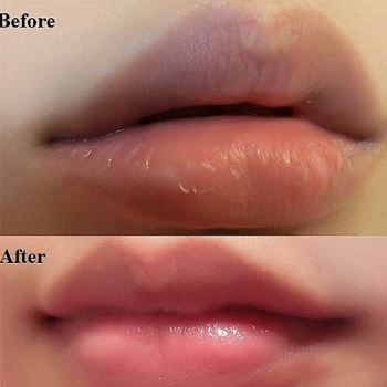 Trick tips to make your lips become bigger!
