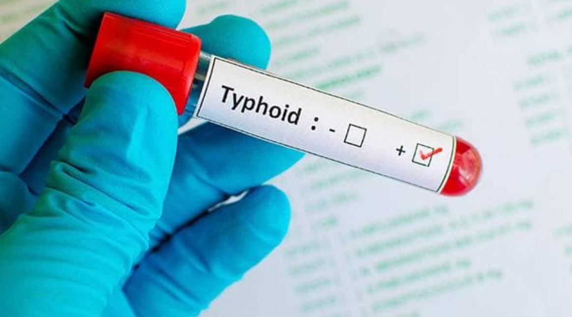 Typhoid Vaccine: What it is & Guideline on Vaccination for International Travel