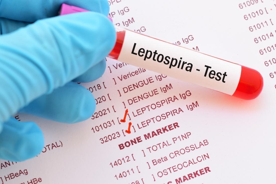 LEPTOSPIROSIS: Symptoms, Causes, Transmission, Treatments for a Common Disease in India