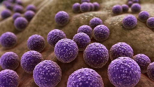 Staphylococcus Aureus: Causes, Symptoms, and Treatment