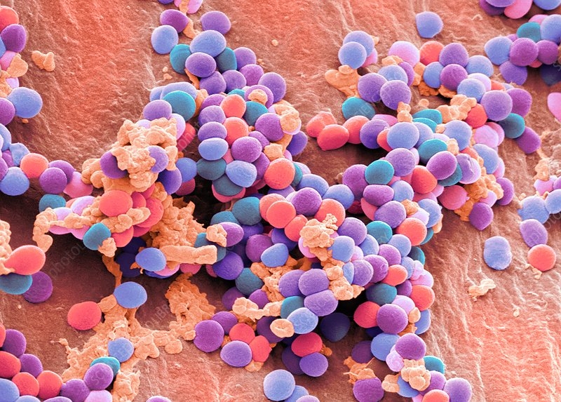 Staphylococcus Aureus: Causes, Symptoms, and Treatment you should know