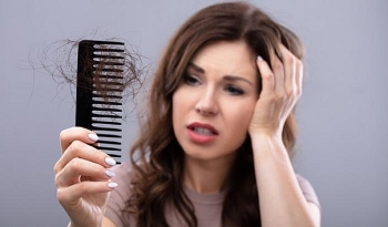 9 Simple but Effective Ways to Avoid Hair Fallout