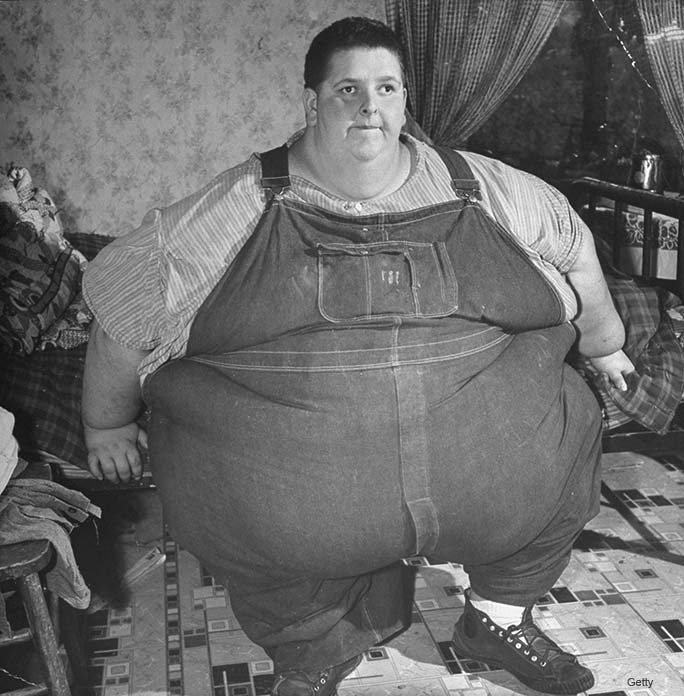 History of heaviest humans as world"s biggest man loses half his body weight