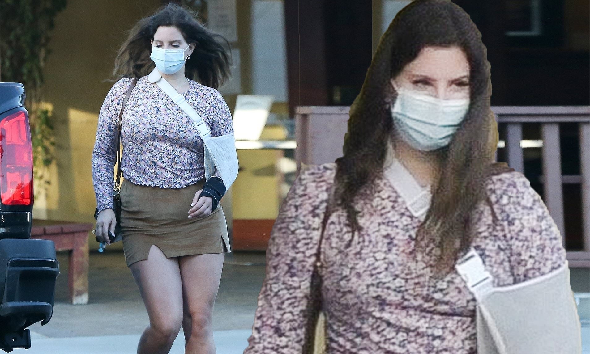 Who is Lana Del Rey- Pop singer-songwriter shares her photo of broken arm?