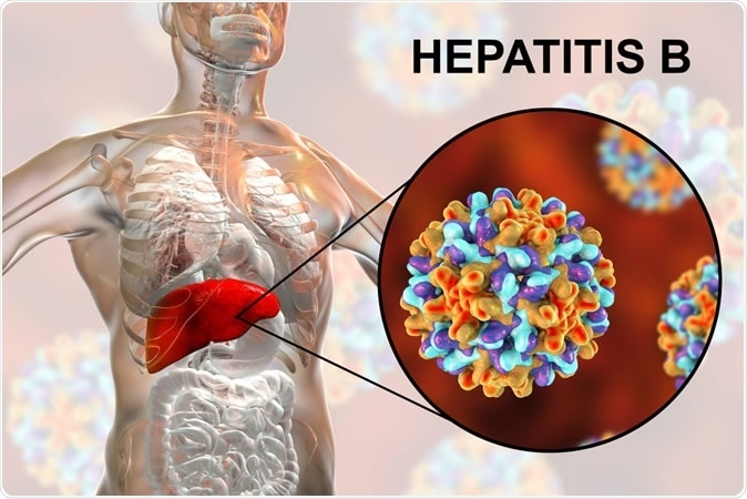 Hepatitis A, B, C, D, E: Causes, Symptoms, Treatment for most common diseases in India