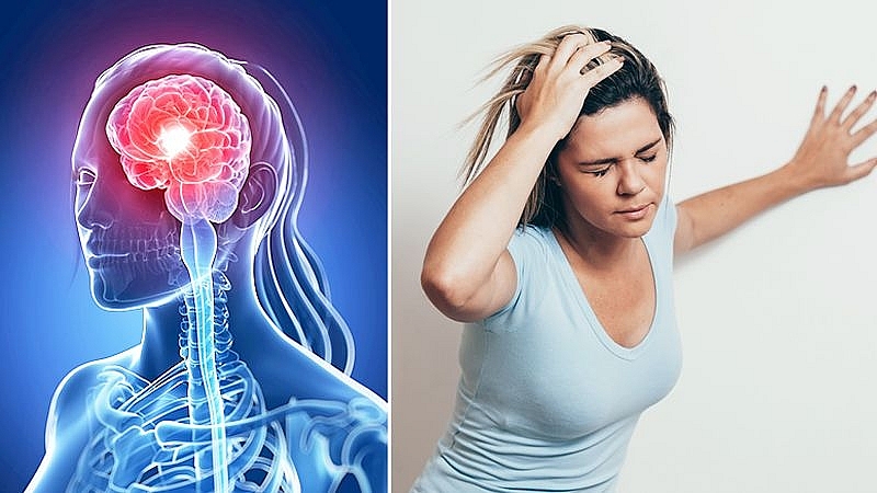 Top Warning Signs of Stroke Before 1 Week, 30 Days to Several Months