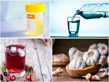 10 treatments of cloudy urine at home