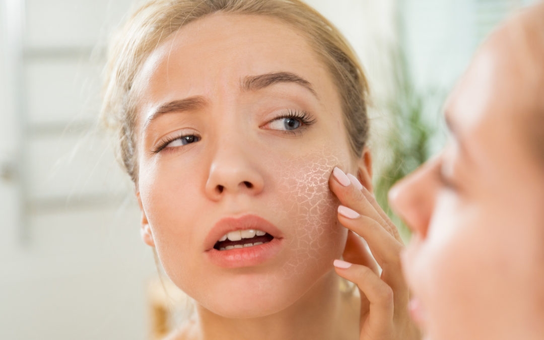6 effective tips to keep your skin moist and healthy