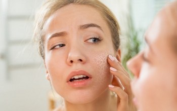 tips to prevent and care for dry skin in winter