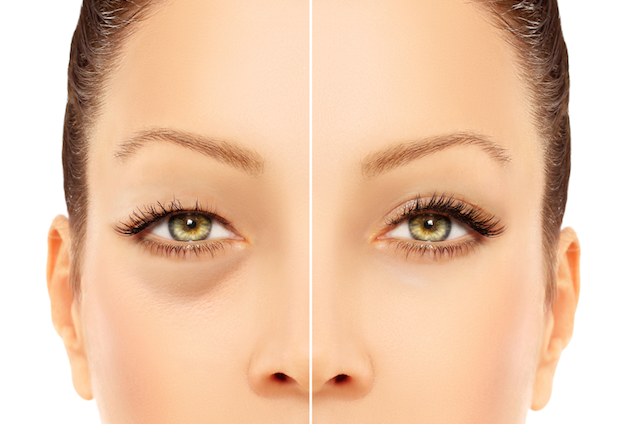 How to Reduce Bags Under Eyes